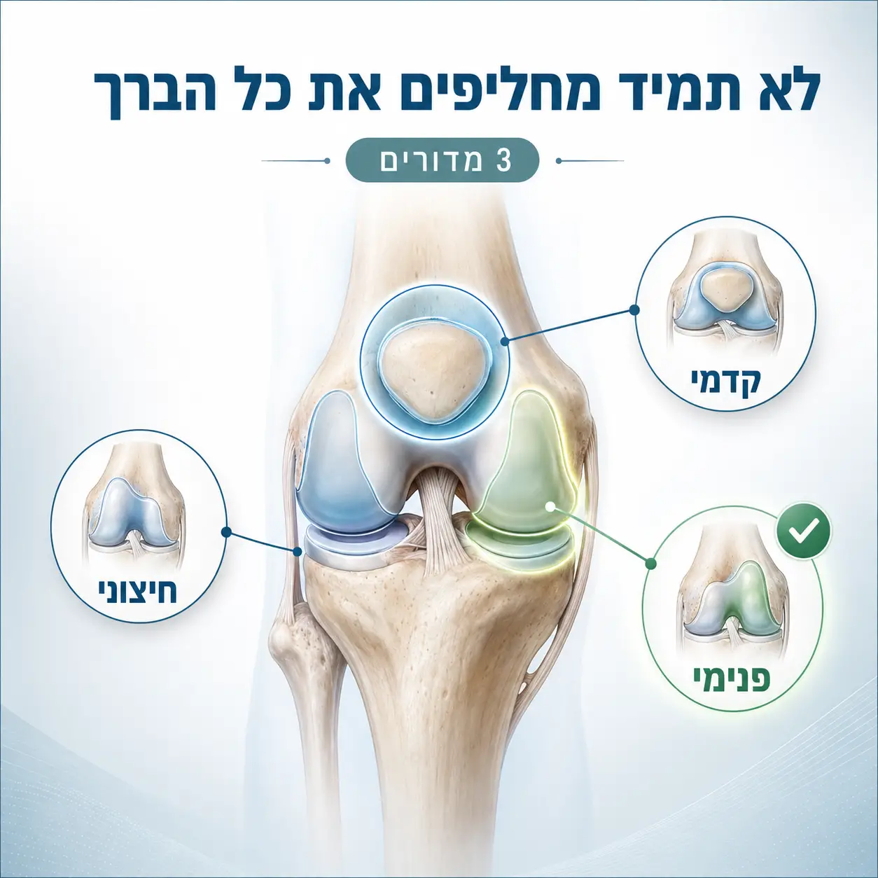 החלפת ברך חלקית | אינפוגרפיקה