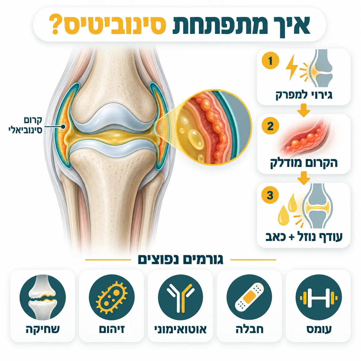 סינוביטיס | אינפוגרפיקה
